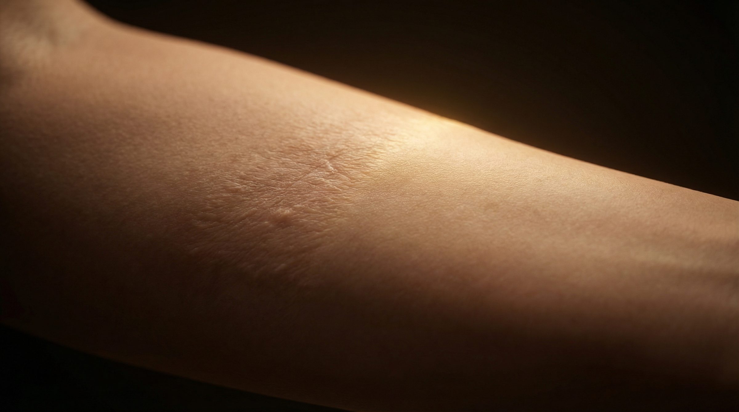 Acne Scar Treatment in Marylebone, London: The Complete Guide to Regenerative Solutions