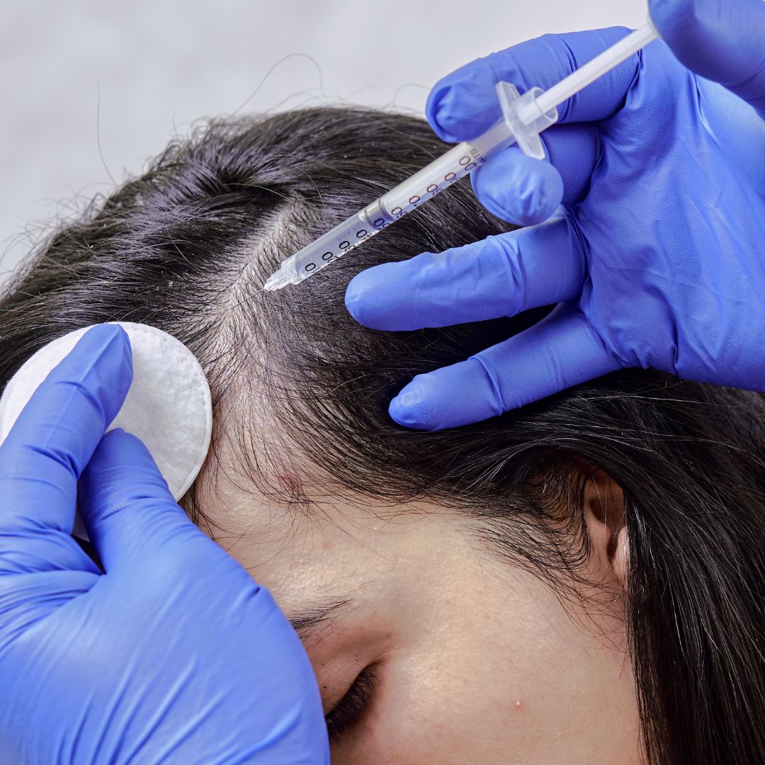 Polynucleotide Hair Treatment treatment at Mesglo London, Marylebone, London