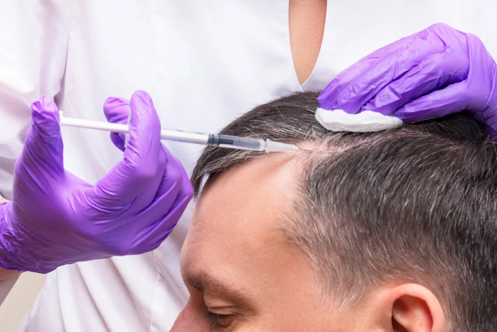 Exosome Hair Treatment treatment at Mesglo London, Marylebone, London