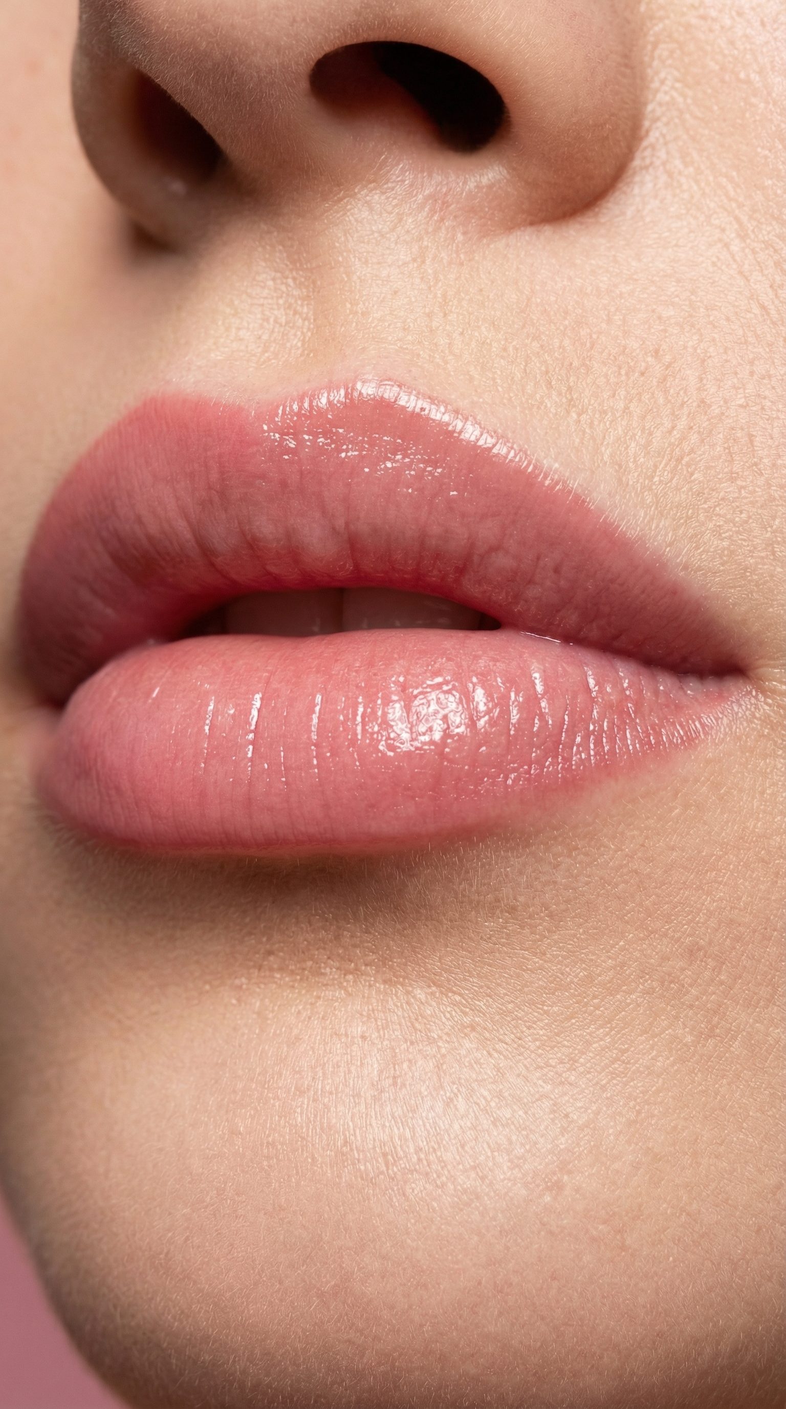 Natural lip enhancement treatment at Mesglo London