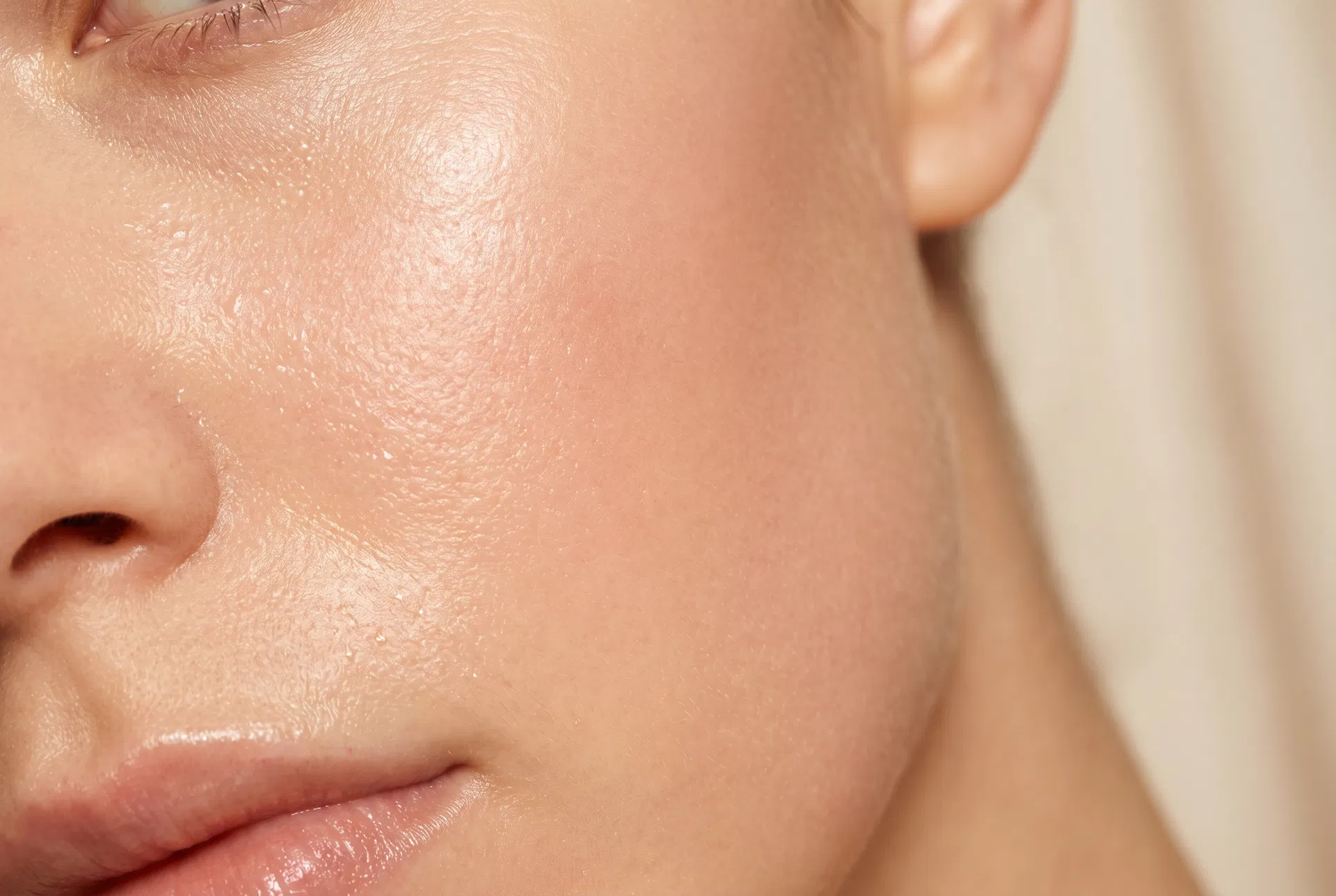 Obagi Blue Radiance Peel treatment at Mesglo London Marylebone