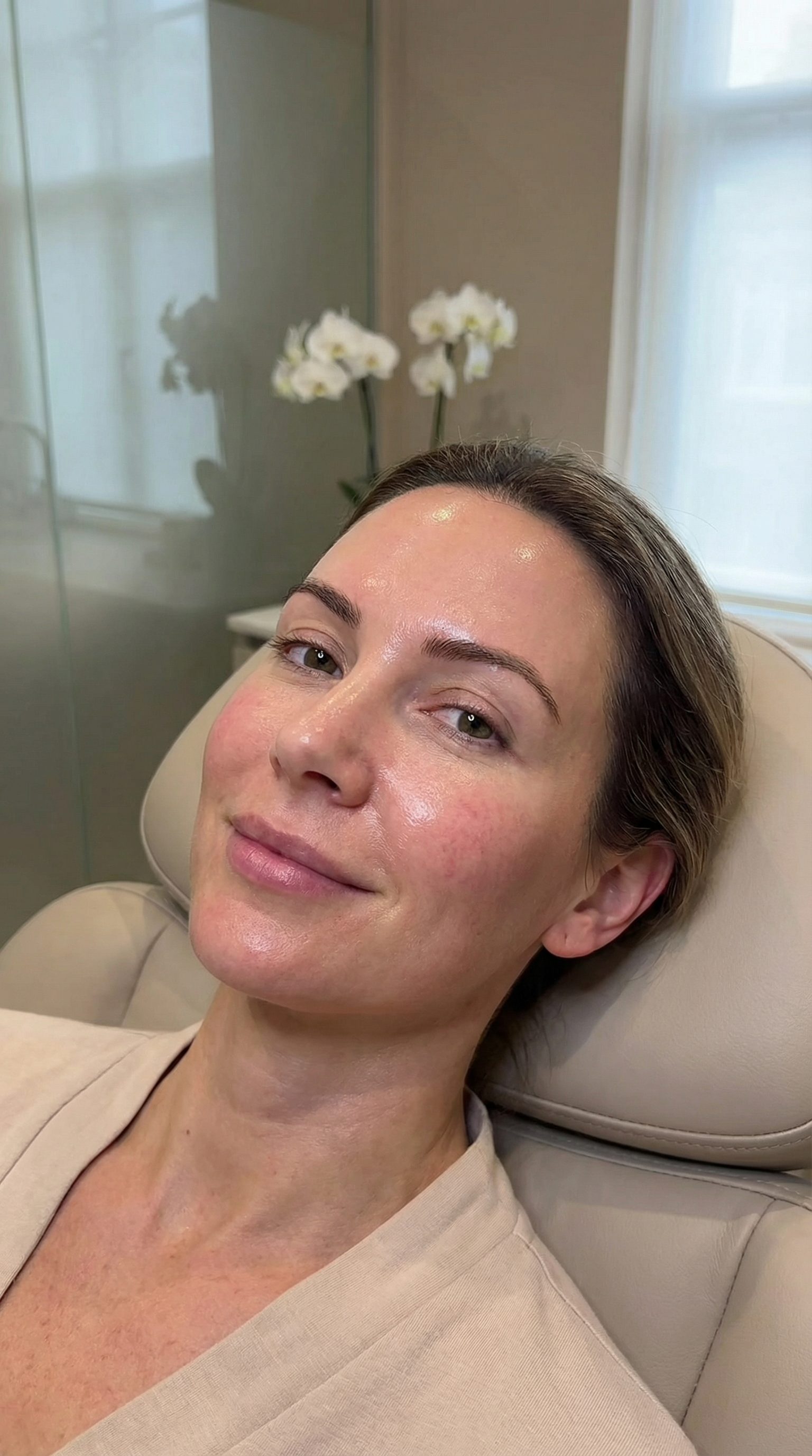 Professional chemical skin peel treatment at Mesglo London