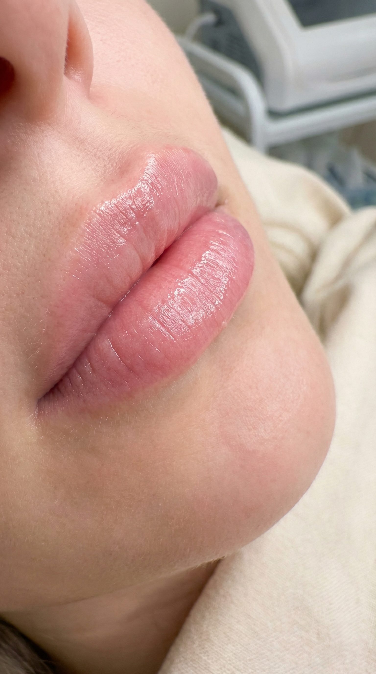 Skinfill Bacio lip treatment at Mesglo London